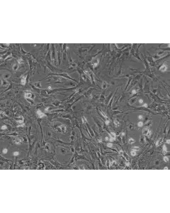 Mouse Hepatic Stellate Cells (MHSteC) - Phase contrast, 100x.
