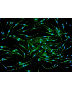 Mouse Macrophages-bone marrow (MMa-bm) - Immunostaining for CD11b, 200x.
