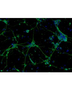 Mouse Neurons-forebrain from C57BL/6