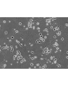 Mouse Neurons-hippocampal (MN-h) - Phase contrast, 200x.
