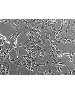 Mouse Meningeal Cells (MMenC) - Phase contrast, 200x.
