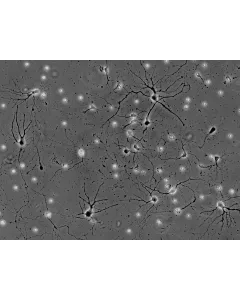 Mouse Neurons-spinal cord (MN-sc) - Phase contrast, 200x.
