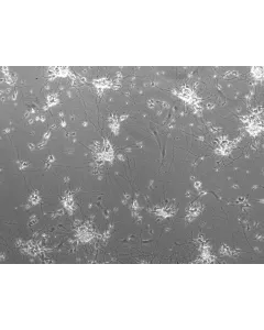 Mouse Neurons-striatal (MN-s) - Phase Contrast, 100x