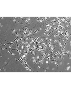 Mouse Neurons-striatal (MN-s) - Phase contrast, 100x.
