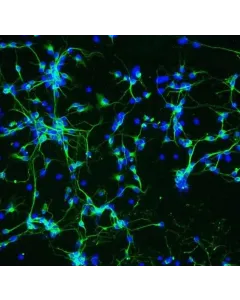 Mouse Neurons-substania nigra (MN-sn) - Immunostaining for β-Tubulin III, 200x.
