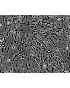 Isolated from postnatal day 8 C57BL/6 mouse sciatic nerve. MPNF are cryopreserved at passage one and delivered frozen. Each vial contains >5 x 10^5 cells in 1 ml volume.