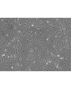 Mouse Pulmonary Fibroblasts (MPF) - Phase contrast, 100x.
