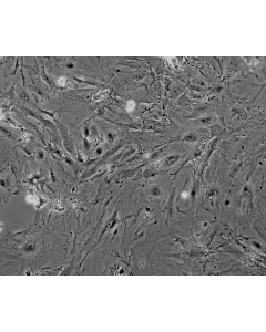 Mouse Renal Mesangial Cells (MRMC) - Phase contrast, 100x.
