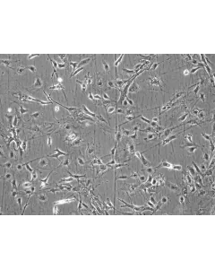 Mouse Renal Mesangial Cells (MRMC) - Phase contrast, 100x.
