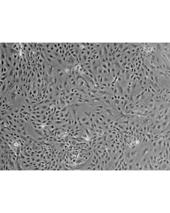 Mouse Renal Proximal Tubular Epithelial Cells (MRPTEpiC) - Phase contrast, 100x.
