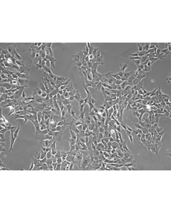 Porcine Retinal Astrocytes (PA-r)- Phase Contrast, 100x.
