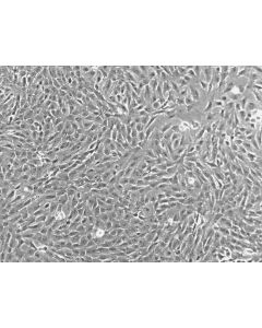 Porcine Retinal Pigment Epithelial Cells (PRPEpic) - Phase Contrast 100X