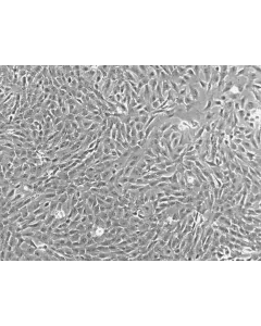 Porcine Retinal Pigment Epithelial Cells (PRPEpic) - Phase Contrast 100X