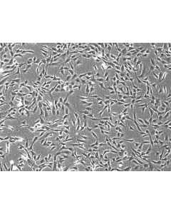 Rabbit Dermal Fibroblasts (RabDF) – Phase Contrast, 100X.

