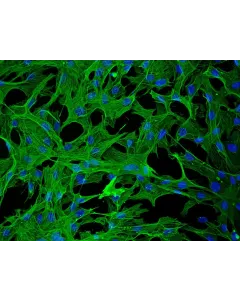 Rabbit Hepatic Stellate Cells (RabHSteC) – Immunostaining for alpha-smooth muscle actin, 200x.
