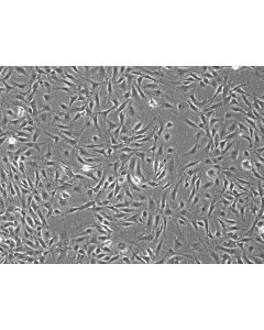 Rabbit Renal Mesangial Cells (RabRMC) – Phase Contrast, 100X.
