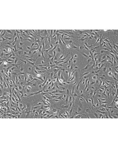 Rabbit Renal Mesangial Cells (RabRMC) – Phase Contrast, 100X.