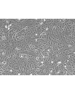 Rabbit Renal Proximal Tubule Epithelial Cells (RabRPTEpiC) – Phase Contrast, 100X.
