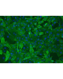 Rat Aortic Smooth Muscle Cells (RASMC) – Immunostaining for α-sma, 200x
