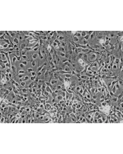 Rat Astrocytes-cerebellar (RA-c) - Phase contrast, 200x.
