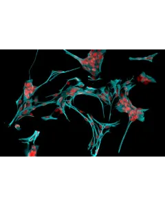 Rat Astrocytes-cerebellar (RA-h) - Immunostaining for GFAP, 200x.
