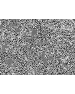 Rat Astrocytes (RA) - Phase contrast, 100x.
