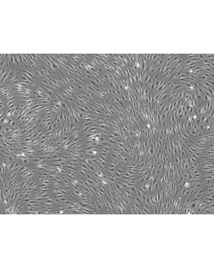 Rat Brain Microvascular Endothelial Cells - Phase contrast, 100x.