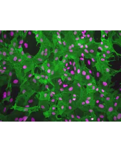 Rat Brain Vascular Pericytes (RBVP)-Immunostaining for α-SMA, 200x.
