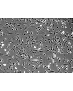 Rat Cardiac Fibroblasts (RCF) - Phase contrast, 100x.