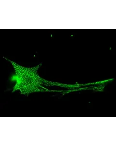 Rat Cardiac Myocytes (RCM) – Immunostaining for Sarcomeric alpha-Actinin (Boster, Cat #MA1104)
