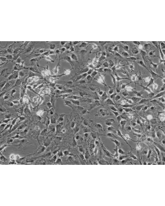 Rat Dermal Fibroblasts (RDF) - Phase contrast, 100x.
