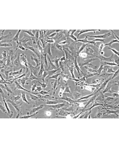 Rat Embryonic Fibroblasts (REF) - Phase contrast, 200x.
