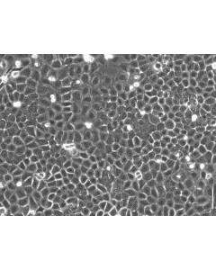 Rat Epidermal Keratinocytes (REK) – Phase Contrast, 200x
