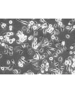 Rat Hepatic Macrophage (RHMa) - Phase contrast, 200x.
