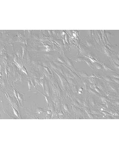 Rat Hepatic Stellate Cells-adult (RHSteC-a)-Relief contrast, 200x.

