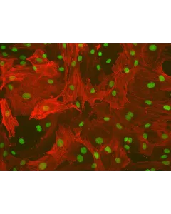 Rat Hepatic Stellate Cells (RHSteC) - Immunostaining for α-SMA, 200x.
