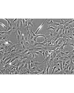 Rat Lens Epithelial Cells (RLEpiC) - Phase contrast, 200x.
