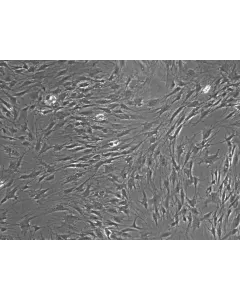 Rat Lymphatic Fibroblasts Phase Contrast