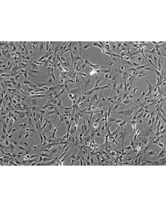 Rat Meningeal Cells (RMC) - Phase contrast, 100x.
