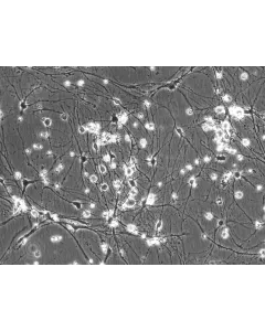 Rat Neurons-raphe (RN-r) - Phase contrast, 200x.
