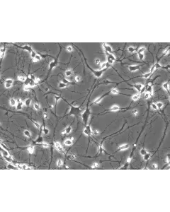 Rat Neurons-striatal (RN-s) - Phase contrast, 200x.
