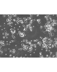 Rat Neurons-substantia nigra (RN-sn) - Phase contrast, 200x.
