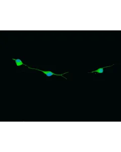 Rat Oligodendrocyte Precursor Cells (ROPC) – Immunostaining for O1, 400x.
