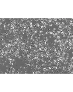 Rat Pulmonary Alveolar Macrophages (RPAMa) - Phase contrast, 100x
