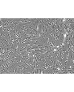 Rat Pulmonary Artery Smooth Muscle Cells (RPASMC)- Phase Contrast, 100x