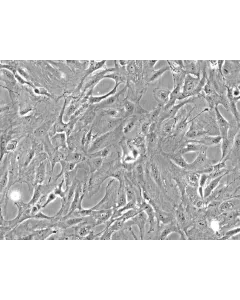 Rat Pulmonary Fibroblasts (RPF) - Phase contrast, 200x.
