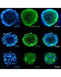 Human Cortical Spheroids at Day 7