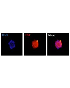 Human Hepatic Sinusoidal Endothelial Cell Spheroids express the endothelial cell marker von Willebrand factor (vWF). 