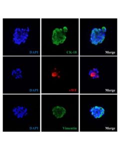 Human mini liver spheroids express hepatocyte marker cytokeratin 18 (CK-18), stellate cell marker vimentin and sinusoidal endothelial cell marker von Willebrand factor (vWF). 