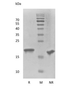 Recombinant Human Fibroblast Growth Factor-21 Thermostable